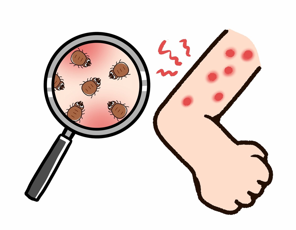 ダニを見つけたらどうするか